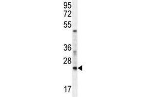 RAN antibody western blot analysis in mouse NIH3T3 lysate.