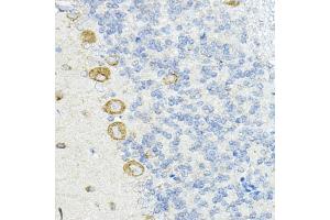 Immunohistochemistry (IHC) image for anti-Leucine Rich Repeat Containing 59 (LRRC59) (AA 1-244) antibody (ABIN6143345)