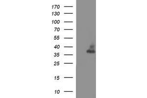 Image no. 3 for anti-Synaptophysin (SYP) antibody (ABIN1501255) (Synaptophysin antibody)
