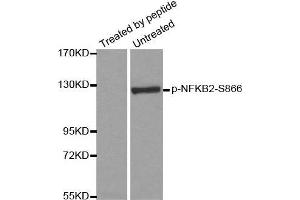 Western blot analysis of extracts from ovary cancer cells, using Phospho-NFKB2-S866 antibody. (NFKB2 antibody  (pSer866))