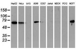 Image no. 3 for anti-Epsin 2 (EPN2) antibody (ABIN1498051) (Epsin 2 antibody)