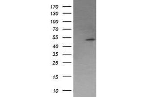 PPM1B antibody