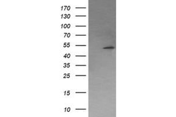 PPM1B antibody