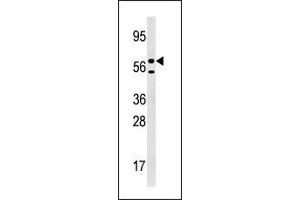 Western blot analysis of anti-URKL1 Pab in 293 cell line lysate (35 µg/lane).