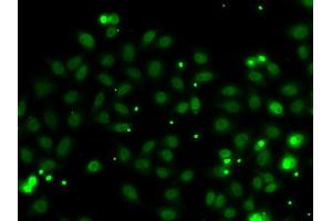 Immunofluorescence analysis of MCF-7 cells using NGFR antibody (ABIN6130898, ABIN6144616, ABIN6144617 and ABIN6223129). (Nerve Growth Factor Receptor (TNFRSF16) Associated Protein 1 (NGFRAP1) (AA 1-111) antibody)
