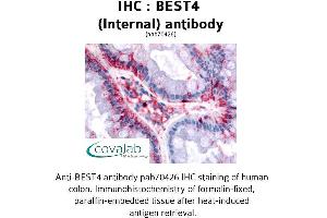 Image no. 1 for anti-Bestrophin 4 (BEST4) (Internal Region) antibody (ABIN1732305)