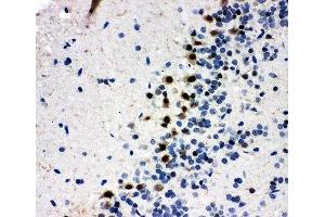 IHC-P: MYBL2 antibody testing of rat brain tissue (MYBL2 antibody  (N-Term))