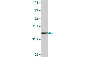 Western Blot detection against Immunogen (37. (SUGT1 antibody  (AA 151-260))