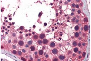 Human Testis: Formalin-Fixed, Paraffin-Embedded (FFPE) (TBK1 antibody  (AA 74-123))