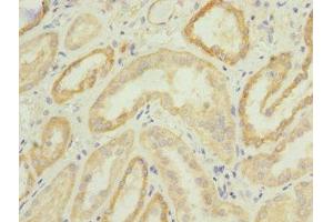 Immunohistochemistry of paraffin-embedded human kidney tissue using ABIN7147920 at dilution of 1:100 (CPSF4 antibody  (AA 1-244))