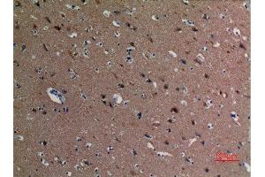 Immunohistochemistry (IHC) analysis of paraffin-embedded Human Brain, antibody was diluted at 1:100. (alpha Tubulin antibody  (acLys40))