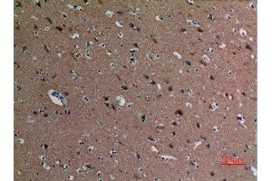 Immunohistochemistry (IHC) analysis of paraffin-embedded Human Brain, antibody was diluted at 1:100. (alpha Tubulin antibody  (acLys40))