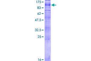 PKD2L1 Protein (AA 1-805) (GST tag)