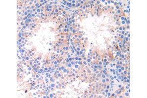 Figure. (THBS4 antibody  (AA 662-923))