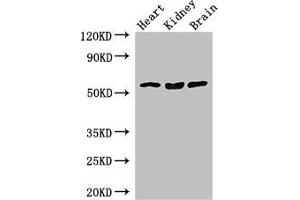 Western Blot Positive WB detected in: Mouse heart tissue, Mouse kidney tissue, Mouse brain tissue All lanes: SLC7A7 antibody at 3. (SLC7A7 antibody  (AA 325-382))