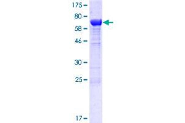 KIAA1609 Protein (AA 1-456) (GST tag)