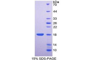SDS-PAGE analysis of Human ENPP1 Protein. (ENPP1 Protein)