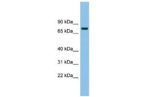 WB Suggested Anti-MTMR14 Antibody Titration: 0. (MTMR14 antibody  (Middle Region))