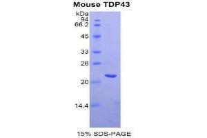 SDS-PAGE (SDS) image for TAR DNA Binding Protein (TARDBP) (AA 104-262) protein (His tag) (ABIN1878235) (TARDBP Protein (AA 104-262) (His tag))