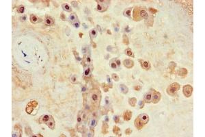 Immunohistochemistry of paraffin-embedded human placenta tissue using ABIN7147837 at dilution of 1:100 (Aryl Hydrocarbon Receptor Nuclear Translocator Homolog (TGO) (AA 184-302) antibody)