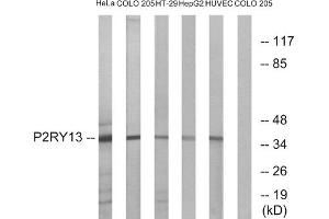 Western blot analysis of extracts from HeLa cells, COLO cells, HT-29 cells, HepG2 cells and HUVEC cells, using P2RY13 antibody. (Purinergic Receptor P2Y, G-Protein Coupled, 13 (P2RY13) (Internal Region) antibody)