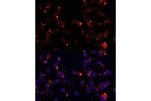 Immunofluorescence analysis of NIH/3T3 cells using WDR81 antibody (ABIN6294099) at dilution of 1:100.