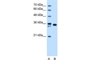Western Blotting (WB) image for anti-Aldo-Keto Reductase Family 1, Member B1 (Aldose Reductase) (AKR1B1) antibody (ABIN2463149) (AKR1B1 antibody)