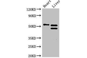 Western Blot Positive WB detected in: Mouse heart tissue, Mouse liver tissue All lanes: COQ6 antibody at 3 μg/mL Secondary Goat polyclonal to rabbit IgG at 1/50000 dilution predicted band size: 51, 49, 43 kDa observed band size: 51, 49 kDa (COQ6 antibody  (AA 208-339))