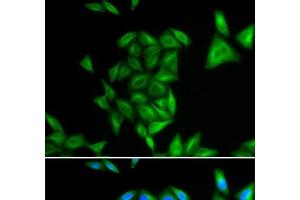 Immunofluorescence analysis of U2OS cells using PHYH Polyclonal Antibody (PHYH antibody)