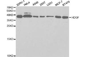 Western blot analysis of extracts of various cell lines, using HDGF antibody. (HDGF antibody)