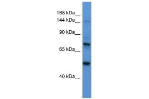 Astrotactin 2 antibody used at 1 ug/ml to detect target protein. (Astrotactin 2 antibody  (N-Term))