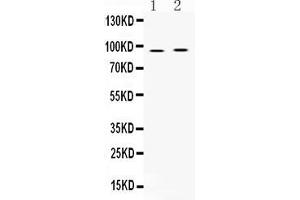 Western blot analysis of AKAP2 expression in rat cardiac muscle extract ( Lane 1) and HEPG2 whole cell lysates ( Lane 2). (AKAP2 antibody  (C-Term))