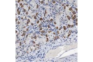 Immunohistochemical staining of human stomach with LRRC55 polyclonal antibody  shows strong cytoplasmic positivity in parietal cells.
