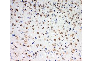 Anti-TrkC antibody,  IHC(P) IHC(P): Rat Brain Tissue