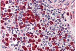 Human Spleen (formalin-fixed, paraffin-embedded) stained with MMP9 antibody ABIN337212 at 5 ug/ml followed by biotinylated goat anti-rabbit IgG secondary antibody ABIN481713, alkaline phosphatase-streptavidin and chromogen. (MMP 9 antibody)