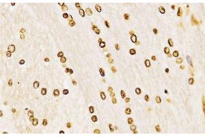 Immunohistochemistry of paraffin-embedded Rat brain using MonoMethyl-Histone H3-K27 Polyclonal Antibody at dilution of 1:200 (40x lens). (Histone 3 antibody  (meLys27))