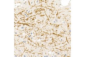 Immunohistochemistry of paraffin-embedded rat brain using Myelin Basic Protein Rabbit pAb (ABIN3022348, ABIN3022349, ABIN3022350 and ABIN6218754) at dilution of 1:100 (40x lens). (MBP antibody  (AA 1-197))