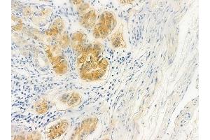 ABIN6258944 and ABIN6275125 at 1/100 staining human normal gastric tissue by IHC-P. (FKBPL antibody  (Internal Region))