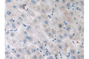 Detection of SIRT4 in Human Liver Tissue using Polyclonal Antibody to Sirtuin 4 (SIRT4) (SIRT4 antibody  (AA 28-314))