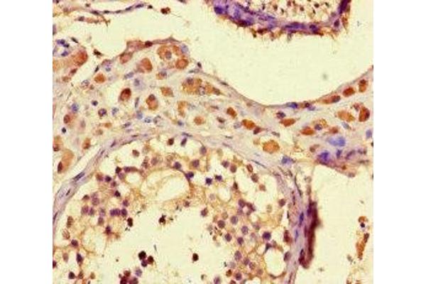 ZNF48 antibody  (AA 317-635)