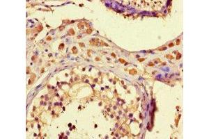 Immunohistochemistry of paraffin-embedded human testis tissue using ABIN7176295 at dilution of 1:100 (ZNF48 antibody  (AA 317-635))
