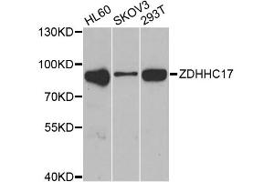 Western blot analysis of extracts of various cell lines, using ZDHHC17 antibody (ABIN2560820) at 1:1000 dilution. (ZDHHC17 antibody)