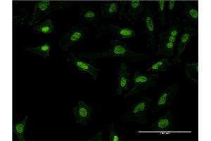Immunofluorescence of monoclonal antibody to PQBP1 on HeLa cell. (PQBP1 antibody  (AA 1-265))