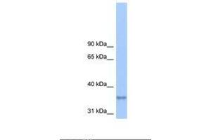 anti-Lipid Phosphate Phosphatase-Related Protein Type 2 (LPPR2) (AA 165-214) antibody