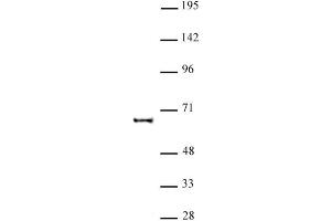 KAT5 antibody (pAb) tested by Western blot. (KAT5 antibody)