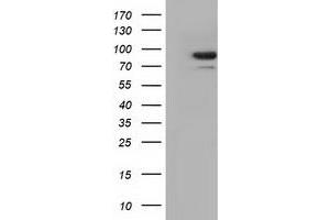 Western Blotting (WB) image for anti-Aldehyde Dehydrogenase 1 Family, Member L1 (ALDH1L1) antibody (ABIN1496581)