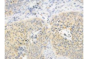 anti-Ribosomal Protein S21 (RPS21) (Internal Region) antibody