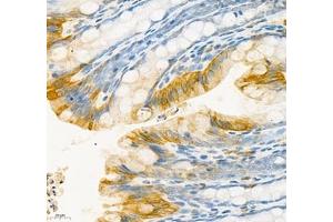 Immunohistochemistry of paraffin embedded rat colon using CEACAM1 (ABIN7073315) at dilution of 1: 650 (400x lens)