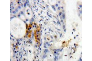 Used in DAB staining on fromalin fixed paraffin-embedded pancreas tissue (REG3g antibody  (AA 39-175))