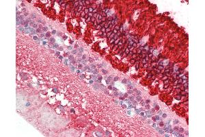 Anti-Rhodopsin / RHO antibody IHC staining of human retina. (Rhodopsin antibody)